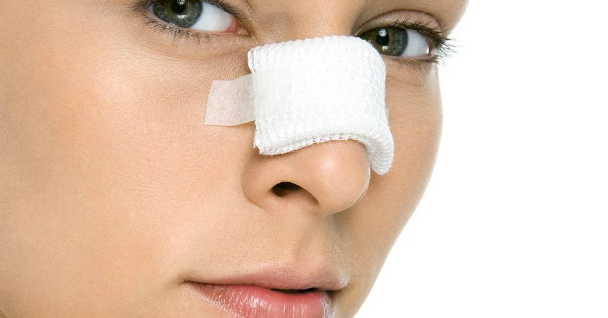 What not to do after rhinoplasty