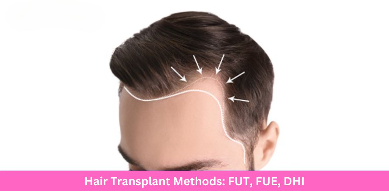 hair transplant in lahore dhi, fut, fue dr farrukh aslam
