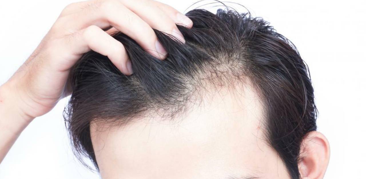Which vitamin deficiency causes hair loss_